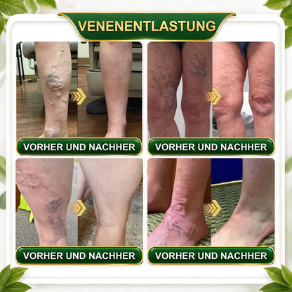 法☘️ GreenFeel® Berbérine, Moringa & Venin d’Abeille – Perles Détox Minceur pour Bain de Pieds, soutenant la gestion du poids, le drainage lymphatique, une circulation saine, le bien-être féminin et une peau visiblement plus ferme. 🔥
