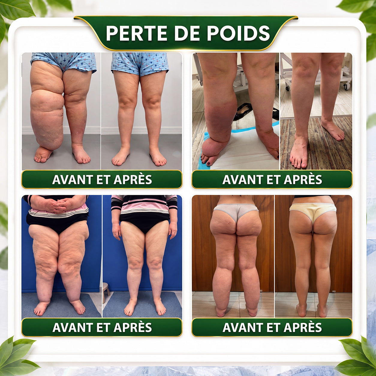 法☘️ GreenFeel® Berbérine, Moringa & Venin d’Abeille – Perles Détox Minceur pour Bain de Pieds, soutenant la gestion du poids, le drainage lymphatique, une circulation saine, le bien-être féminin et une peau visiblement plus ferme. 🔥